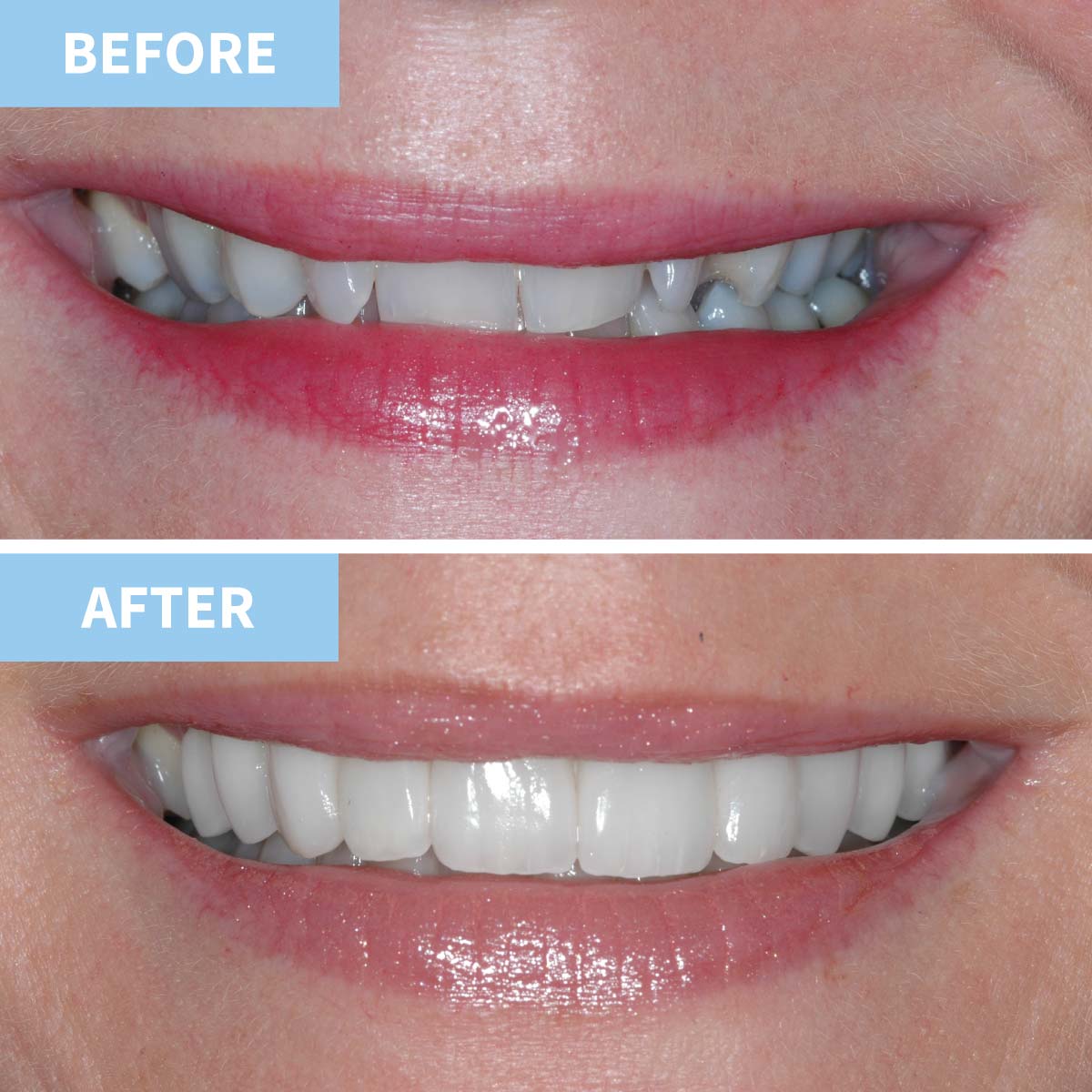 Cosmetic Dentistry | Murray Dental Omagh