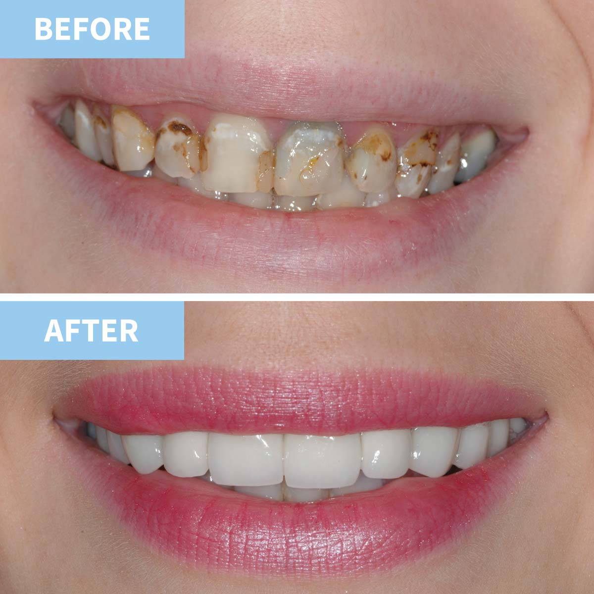 Cosmetic Dentistry | Murray Dental Omagh